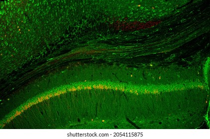 Confocal laser scanning microscopy image of immunofluorescence- labelled cells in the hippocampus of the mouse brain. Corpus callosum fibers are also seen.