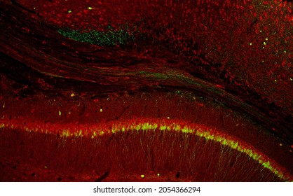 Confocal laser scanning microscopy image of immunofluorescence- labelled cells in the hippocampus of the mouse brain. Callosal fibers and part of the cortex