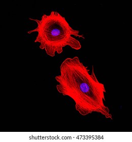 Confocal microscopy imaging of two cancer cells. Cytoskeletal protein actin in red, nucleus in blue.