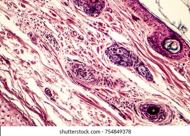 Connective tissue located at human outer ear, light micrograph. Hematoxylin and eosin stain