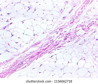 A connective tissue septum, rich in collagen fibers, cross the adipose tissue of the hypodermis of a thin skin.