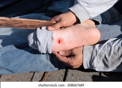 A Construction Worker Shows A Puncture Wound In His Foot After Stepping On A Nail On A Construction Site. Stepping On A Nail Hurts A Lot And Can Cause Nerve Damage . Time For A Tetanus Shot