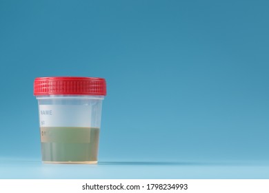 Container Biomaterials Urine Analysis Red Lid Stock Photo 1798234993 ...