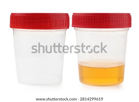 Container with urine sample for analysis and one empty on white background