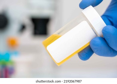 Container Urine Sample Microbiological Laboratory Analysis Stock Photo ...