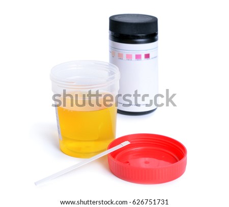Container with urine and test-strips for the analysis.  Isolated on white background.