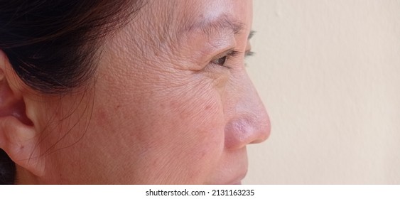 The Corner Of The Woman's Eye Has Wrinkles.