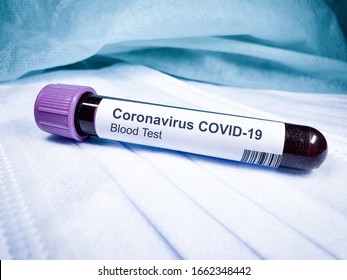 Coronavirus COVID 19 NCov Outbreak. New Corona Virus Blood Test Tube From Patient. Positive Case Of Korona Virus Europe, Italy, Wuhan, China. Epidemic And Pandemic Infection 