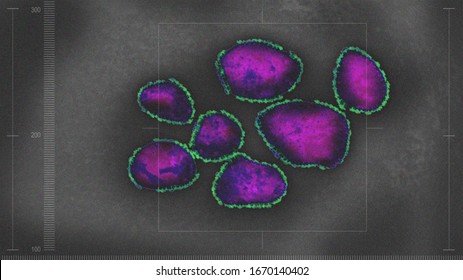 Coronavirus Of COVID-19 Under The Microscope - Illustration Concept