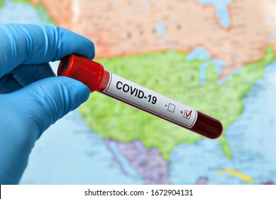 Coronavirus Epidemic In America Is Rapidly Progressing