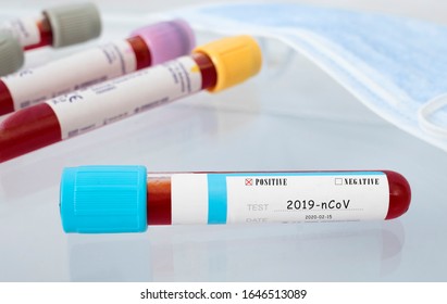 Coronavirus Positive Test Tube. Ncov Positive Blood Sample