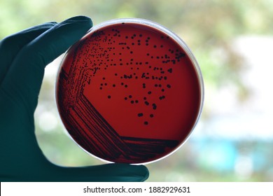 Corynebacterium on tellurite blood agar, Corynebacterium, Bacteria culture, Diphtheria colonies, Single colony isolation, Microbiology, Bacteria, Tellurite blood agar, Black colony, Diphtheria