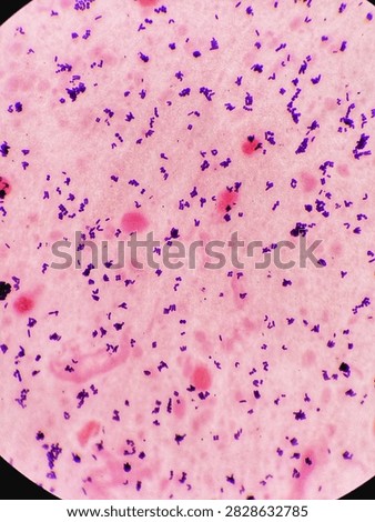 Corynebacterium ulcerans under microscope. 100x