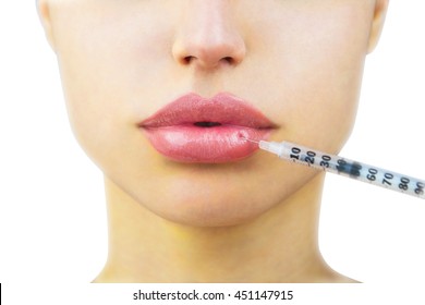 Cosmetic Injection In The Lower Lip Of Unrecognizable Woman, Close-up. Beautiful Big Lips. Plastic And Aesthetic Surgery