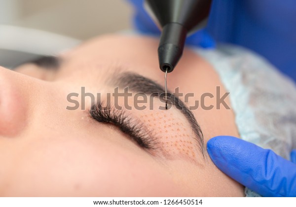 Cosmetic procedure to strengthen the skin\
of the eyelids. Non-surgical blepharoplasty on plasma IQ apparatus.\
Cosmetology for facial\
rejuvenation.