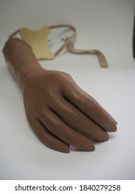 A cosmetic prosthetic hand with suspension for amputees.