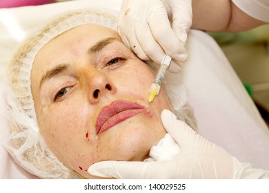 Cosmetic treatment with botox injection in a clinic