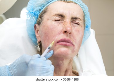 Cosmetic treatment with injection in a clinic - Shutterstock ID 356844188