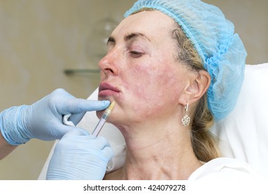 Cosmetic treatment with injection in a clinic - Shutterstock ID 424079278