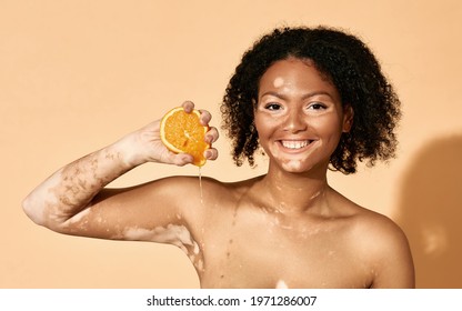 Cosmetics With Vitamin C For Pigmented Skin. Positive African American Woman With Vitiligo Disease Squeezing Orange Near Her Face