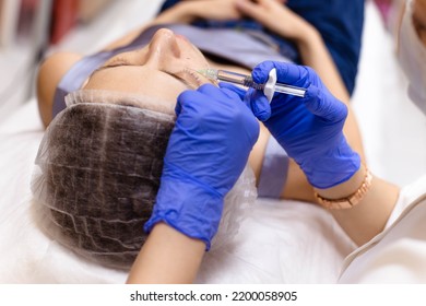 Cosmetologist Doctor Is Making Multiple Injections Biorevitalization With Hyaluronic Acid In Woman Face Skin On Cheek, Closeup.