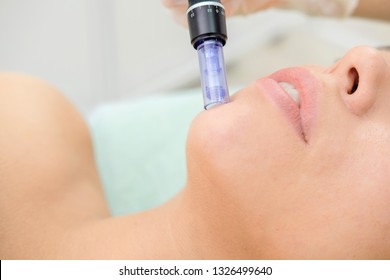 Cosmetologist making mesotherapy injection. Microneedle mesotherapy. Treatment woman at beautician. Hardware cosmetology. Mesotherapy, dermapen, treatment of face zone, face rejuvenation.  Close up