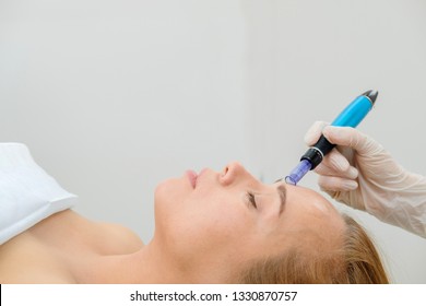 Cosmetologist making mesotherapy injection. Microneedle mesotherapy. Treatment woman at beautician. Hardware cosmetology. Mesotherapy, dermapen, treatment of face zone, face rejuvenation.  Close up