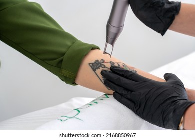 Cosmetologist using laser device to remove an unwanted tattoo from female arm. Concept of erasing tattoos as an expensive procedure in a cosmetology clinic