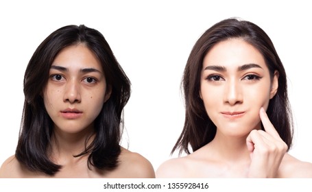 Cosmetology concept. Beautiful young asian woman has freckles, blemish, acne and dull skin, compare another side charming beautiful woman has nice and bright skin of face. Attractive girl get happy - Shutterstock ID 1355928416