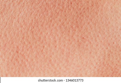 Cosmetology textured background from pink healthy human skin close-up anomie, covered with pores and wrinkles crawl