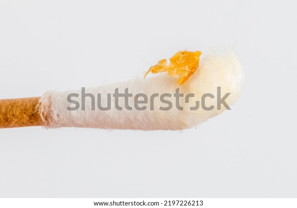 Cotton\
swab with ear wax. Ear wax after cleaning\
ear.