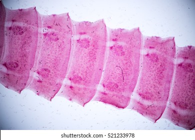 Cotugnia sp.(parasite) under the microscope