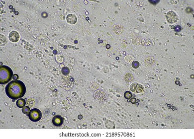 Coughing Up Mucus And Phlegm From A Chest Infection From A Virus And Bacteria Infection, Looking At It Under The Microscope, With Cells And Microorganisms. Bacteria And Skin Cells Close Up