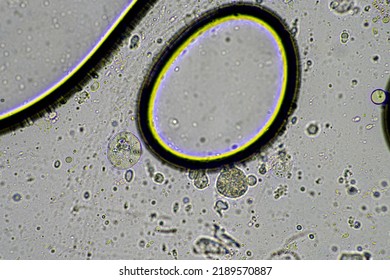 Coughing up mucus and phlegm from a chest infection from a virus and bacteria infection, looking at it under the microscope, with cells and microorganisms. Bacteria and skin cells close up - Powered by Shutterstock