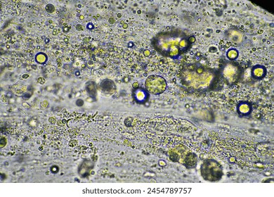 Coughing up mucus and phlegm from a chest infection from a virus and bacteria infection, looking at it under the microscope, with cells and microorganisms. Bacteria and skin cells in a human - Powered by Shutterstock