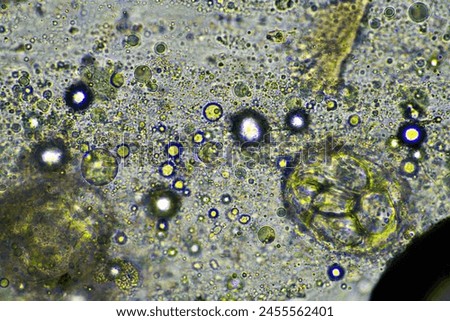 Coughing up mucus and phlegm from a chest infection from a virus and bacteria infection, looking at it under the microscope, with cells and microorganisms. Bacteria and skin cells in a human
