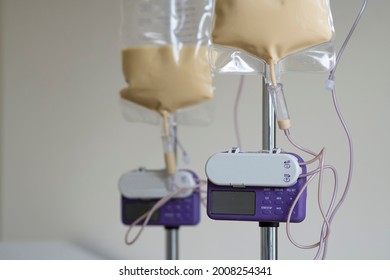 Couple of feeding pump medical device purple color to supplement nutrition liquid food to tube enteral feeding fluid set bag with clamp hanging on stand.