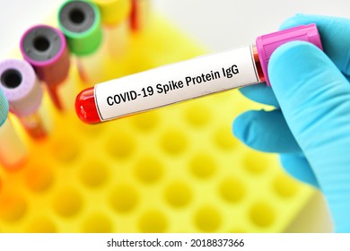 COVID-19 antibody test, blood sample tube for COVID-19 IgG antibody test, after vaccination