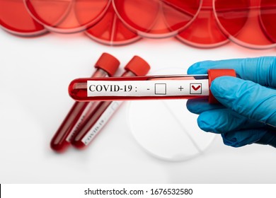 COVID-19. Corona Virus In Lab.  Coronavirus Blood Sample COVID-19. Petri Dish And Test Tubes With Blood In The Laboratory. Blood Coronavirus Test.Virus Vaccine Development