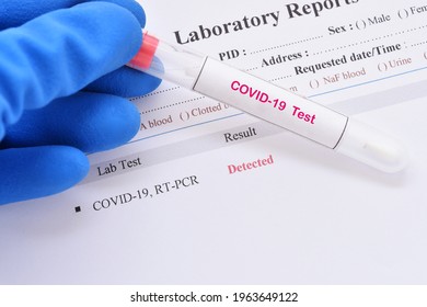 COVID-19 detected result, laboratory report of COVID-19 testing by using RT-PCR method, the result showed detected or positive 
