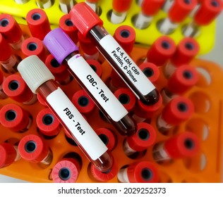 Covid-19 Patient Monitoring Tests. Covid Patient Routine Tests.