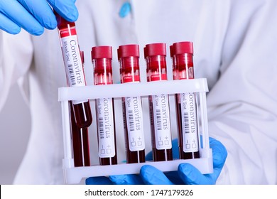 383 Blood test ads Images, Stock Photos & Vectors | Shutterstock