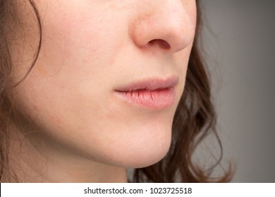 Cracked Lips Of Female Mouth