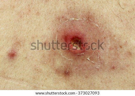 umbilicus Fluff Navel