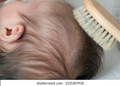 Cradle cap comb removing from baby scalp - Shutterstock ID 1525307918