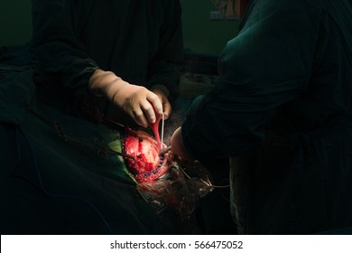 Craniotomy