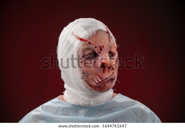 Crazy zombie horror make up. Person in blue madical\
shirt and bandaged head. Scars, deep scratches realistic art\
make-up. head is re-banded bandage, beaten with a stick. banner for\
Halloween party