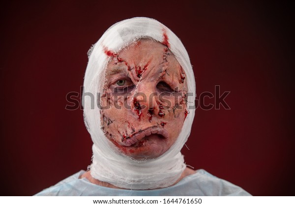 Crazy zombie horror make up. Person in blue madical
shirt and bandaged head. Scars, deep scratches realistic art
make-up. head is re-banded bandage, beaten with a stick. banner for
Halloween party