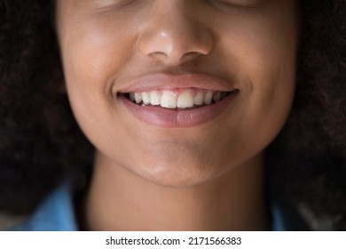 Cropped Close Up Face View Lower Part Of Young Beautiful African Girl, Smile Reveal White Teeth Advertise Dental Clinic, Having Pure Perfect Facial Skin, Cleansing Products, Teen-age Cream Ad Concept