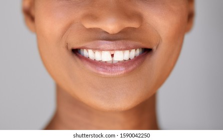 Cropped closeup of a young African American woman with beautiful skin and a big smile - Powered by Shutterstock